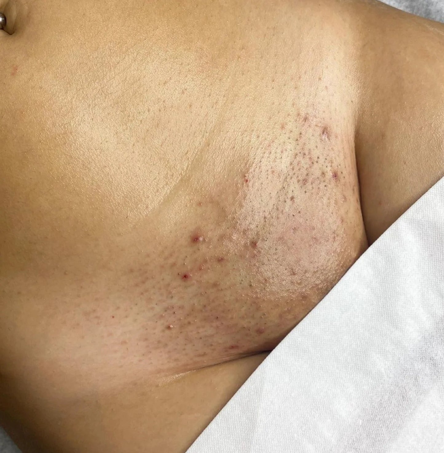 POILS INCARNES OIL 200ML- NUDE