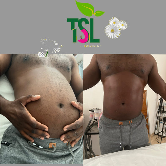 Package Body Sculpting Fat Removal