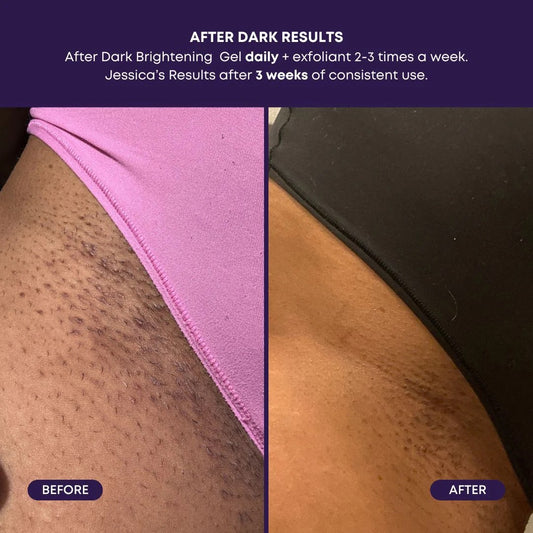 The Overnight Brightening Routine