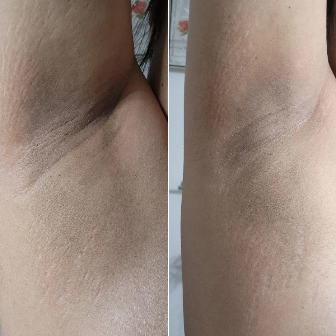 Radiant Reset Exfoliating Toner Pads