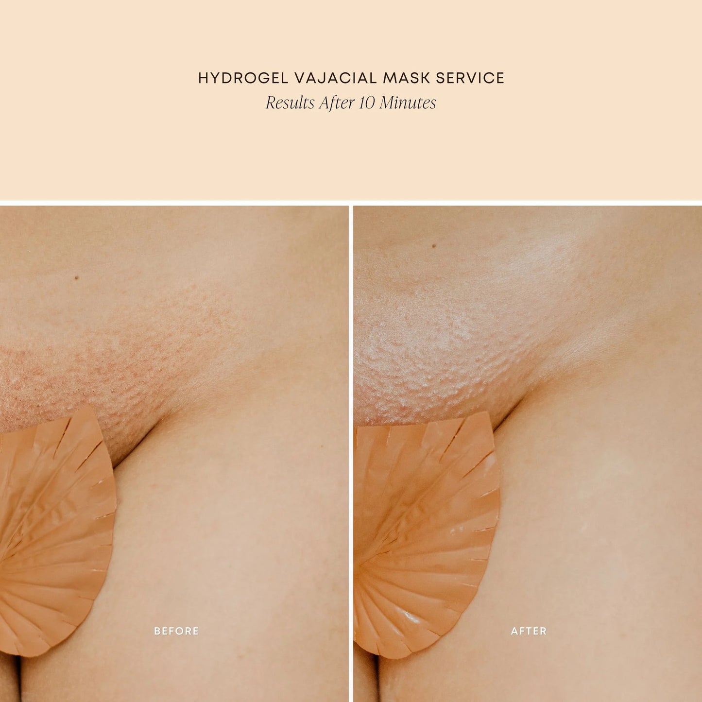 Hydrogel Vajacial Mask