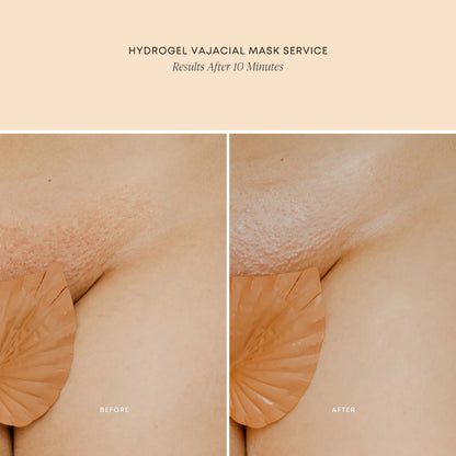 Hydrogel Vajacial Mask