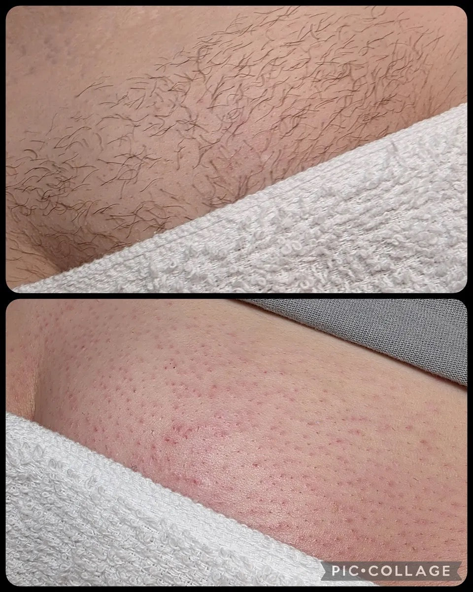 POILS INCARNES OIL 200ML- NUDE