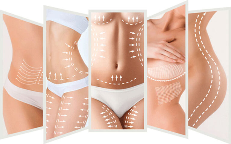 Package Body Sculpting Fat Removal